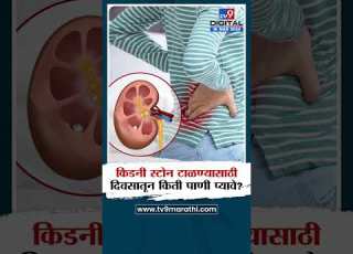 Kidney Stone क डन स ट नच त र स ट ळण य स ठ र ज क त ग ल स प ण प य व TV9D