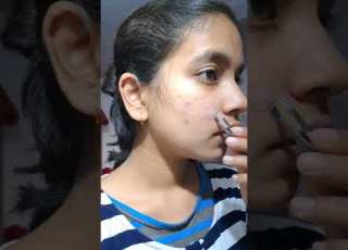 I Tried A Pimple Patch Shorts Youtubeshorts Youtube Trending Skincare Youtuber