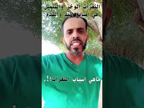اسباب النغزات والوخز في الاصابع