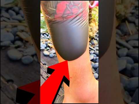 Perché Il Tatuaggio Fa Quella Bolla Shorts Perte