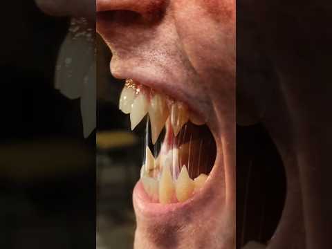 Werewolf Attacks The Set Of Wolf Man