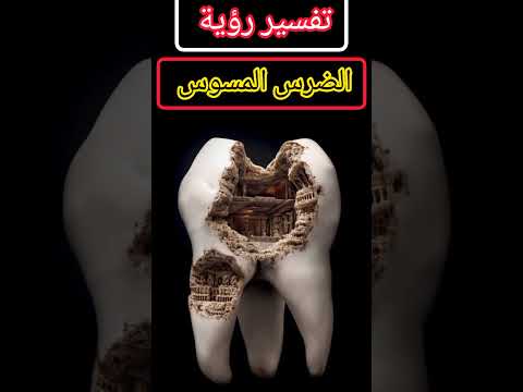 تفسير رؤية الضرس المسوس في الحلم