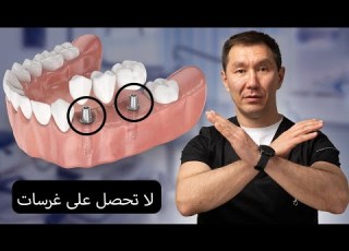  لا ت جر ب زراعة أسنان قبل أن تعرف هذا أطباء الأسنان لا يخبرونك الحقيقة