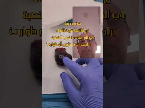 الم الخصية لا تهمله