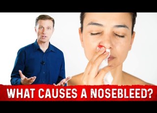 What Causes Nosebleeds Epistaxis 8 Common Causes Of Nose Bleeding Dr Berg