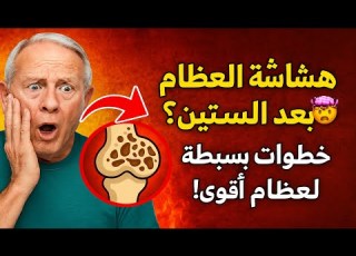 هشاشة العظام بعد الستين 6 خطوات بسيطة لعظام أقوى