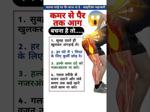 Sciatica Ka Dard Viralvideo Viralshorts Sciatica Physiodrdeepaksoni