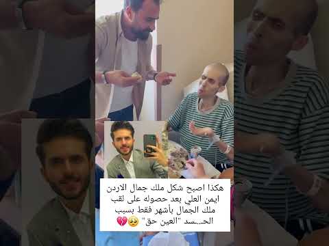 هكذا اصبح شكل ملك جمال الأردن ايمن العلي متابعه ولايك تابعوني