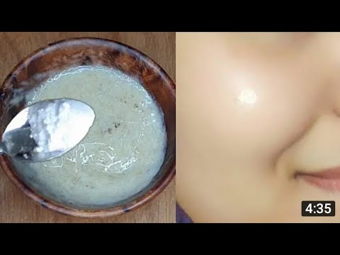 Yanda Ake Cire Duk Wasu Kuraje Ko Dirty A Fuska Cikin Minti Biyu 2mint How Remove Pimples Dark Spot Yanda Ake Cire Duk Wasu Kuraje Ko Dirty A Fuska Cikin Minti Biyu 2mint How Remove Pimples Dark Spot