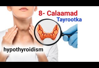 8 Calaamad Xanuunka Thyroid Nooca Dhacsan Hypothyroidism Ma Isku Aragtay