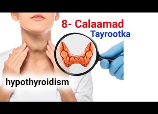 8 Calaamad Xanuunka Thyroid Nooca Dhacsan Hypothyroidism Ma Isku Aragtay