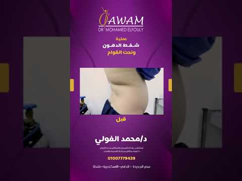 نتائج مبهرة و من أول يوم عملية شفط الدهون و نحت القوام هتديكى شكل الجسم المثالى اللى بتحلمى بيه