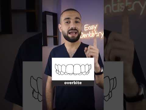 ٥ اشكال للاسنان تحتاج لتقويم الاسنان انت منهم ٥ اشكال للاسنان تحتاج لتقويم الاسنان انت منهم