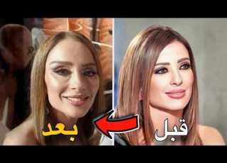  اكثر 10 فنانات تغيرت ملامحهم بسبب عمليات التجميل صور صادمة