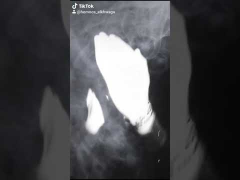 فاتح بيبان اي عراك مرجعش خطوه تسحب سلاح انتا وهواك هفرك المطوه تيك توك Homoos Elkhwaga فاتح بيبان اي عراك مرجعش خطوه تسحب سلاح انتا وهواك هفرك المطوه تيك توك Homoos Elkhwaga