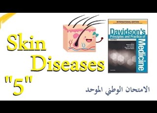 الأمراض الجلدية 5 الفقاع الفقاعاني الفقاع الشائع Pemphigus Vulgaris Bullas Pemphigoid
