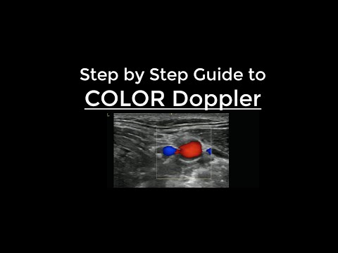 How To Use Color Doppler On Ultrasound Step By Step Guide How To Use Color Doppler On Ultrasound Step By Step Guide