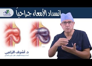 علاج انسداد الأمعاء جراحيا أ د اشرف الزغبي