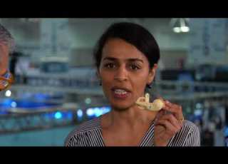 Treatments For The Growing Problem Of Hearing Loss Sensorion S Nawal Ouzren