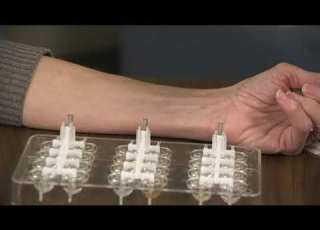 How We Do Skin Tests For Allergies