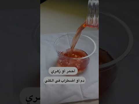 علاقة لون البول بصحتك تأثير لون البول على صحتك البول الاخراج صحتك حياتك الكلى الكبد اكسبلور علاقة لون البول بصحتك تأثير لون البول على صحتك البول الاخراج صحتك حياتك الكلى الكبد اكسبلور