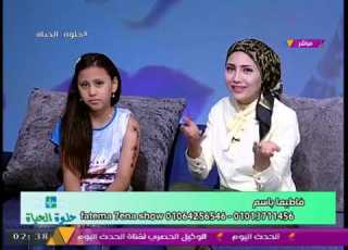  فاطيما باسم تكشف عن أضرار الحنة وخطوات معرفة هل عندك حساسية من الحنة والا لا