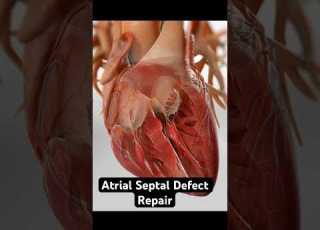  Repairing A Hole In Your Heart 3D Animation