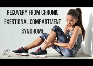 Recovery From Chronic Exertional Compartment Syndrome CECS