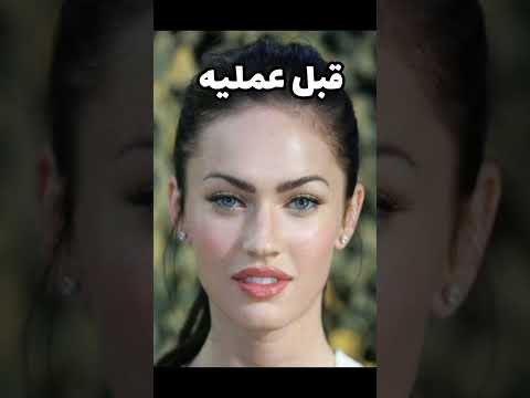 أفشل عمليات التجميل راح تنصدمون من الأشكال