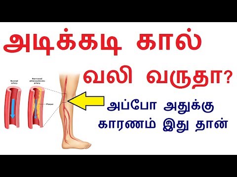 உங கள க க அட க கட க ல வல வர த அப ப அத க க க ரணம இத த ன