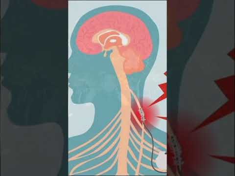 علاج ضربات القلب السريعة بدون أدوية علاج ضربات القلب السريعة بدون أدوية