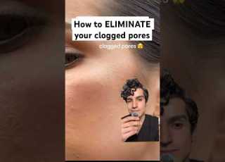 Derm Reveals How To Treat Your Clogged Pores Cloggedpores Pores Dermatologist Whiteheads
