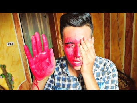 مقلب في احمد عيني اتفقعت ومش بشوف خالص شوفو رد فعلو مقلب في احمد عيني اتفقعت ومش بشوف خالص شوفو رد فعلو