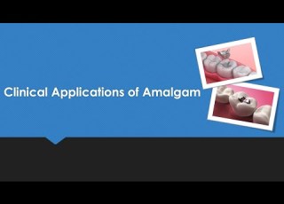  Clinical Application Of Amalgam Restorations 2025 Record