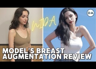  Plastic Surgery Korea Breast Augmentation Review From Model Nida