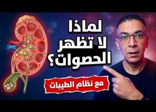الدكتور ضياء العوضي كيف تتكون حصوات الكلى و المرارة ولماذا يمنعها نظام الطيبات