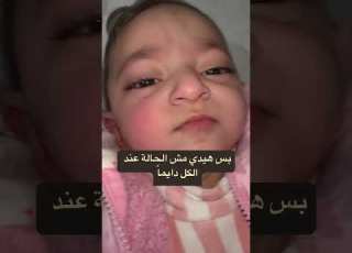من النادر ظهور الأنياب قبل الاسنان الامامية ولكن لا داعي للقلق لو حصل هذا
