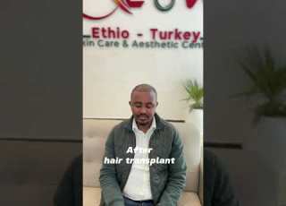 Refresh Your Look With Us Hairtransplant Healthhair Ethiopia Skin የፀጉር Habesha Thebest
