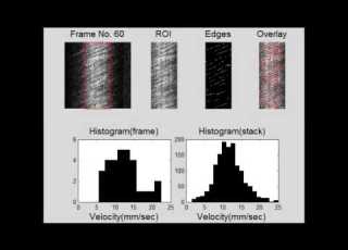  Adaptive Optics SLO Imaging Combined With Widefield OCT And SLO Enables Precise 3D Localization