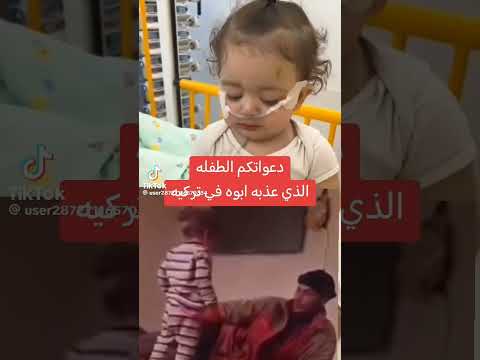 الأب الذي ضرب بنته حسبي الله ونعم الوكيل فيه اكسبلور البنت اكسبلور