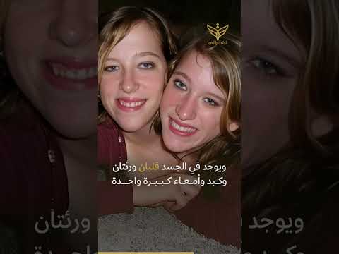 زواج يخلق كثير من الأسئلة حوله ما قصة زواج التوأم الملتصق آبي هنسل وبريتاني