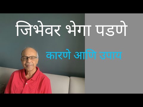 ज भ वर भ ग पडण क रण आण उप यय जन