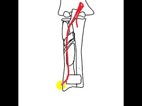 Radial A In Forearm DR SAME GHAZY