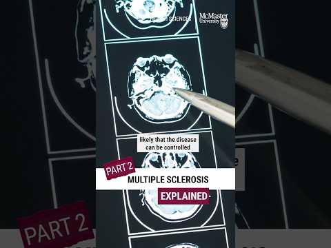 PT2 Multiple Sclerosis Explained Here S What You Need To Know About MS Multiplesclerosis Shorts