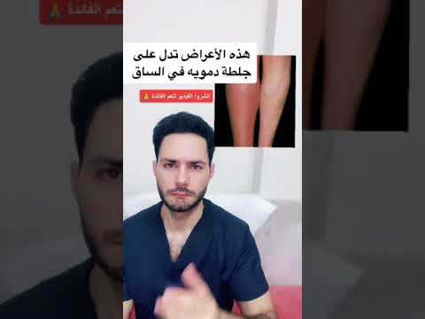 احذر من هذه الأعراض قد تدل على جلطة في ساق د خلدون الحوراني احذر من هذه الأعراض قد تدل على جلطة في ساق د خلدون الحوراني