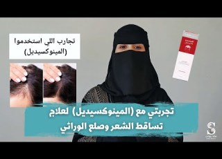 حل مشكلة تساقط الشعر تجربتي مع علاج المينويديل Minoxidil Result