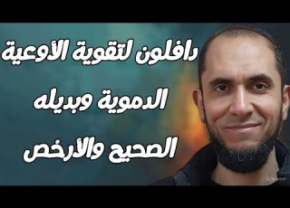 دافلون لتقوية الأوعية الدموية وبديله الصحيح والأرخص د أحمد رجب