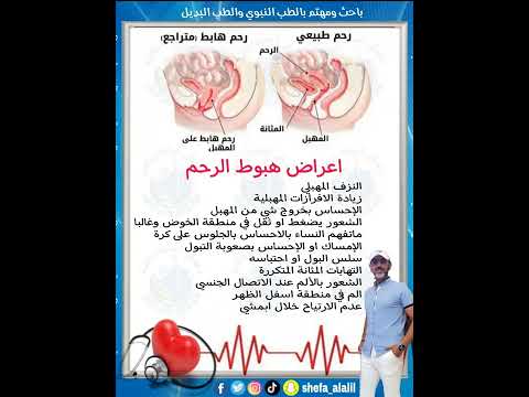 اعراض هبوط الرحم