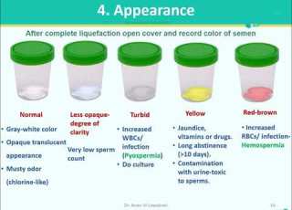  Semen Analysis Part 1 Macroscopic Examination