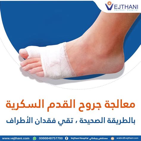 أدوية الصرع لمعالجة الإحساس بالحرقان في القدم السكرية